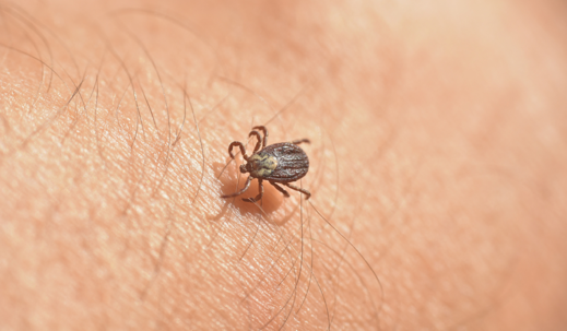Infected tick on hairy human skin