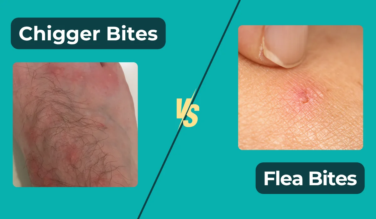 chigger vs flea bites