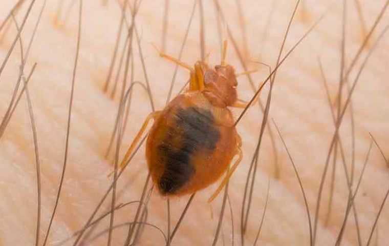 bedbug on skin in south Florida